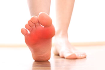 Why Do My Toes Cramp? - Podiatrist & Foot Surgeon LA - Blog